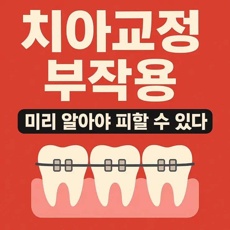 치아교정 부작용 미리 알아야 피할 수 있습니다
