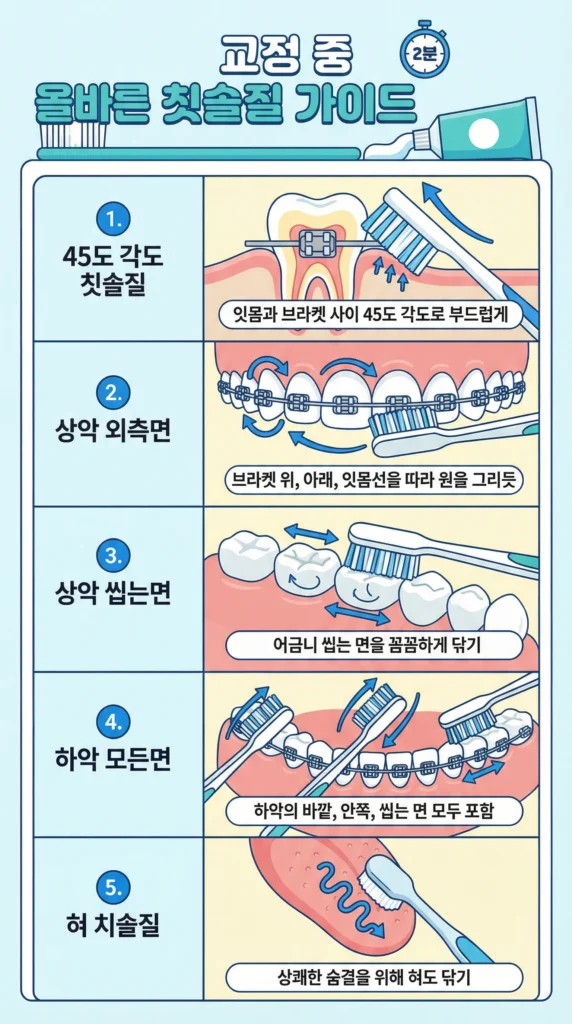 치아교정 종류 비용 양치질 치솔질 잇솔질 방법