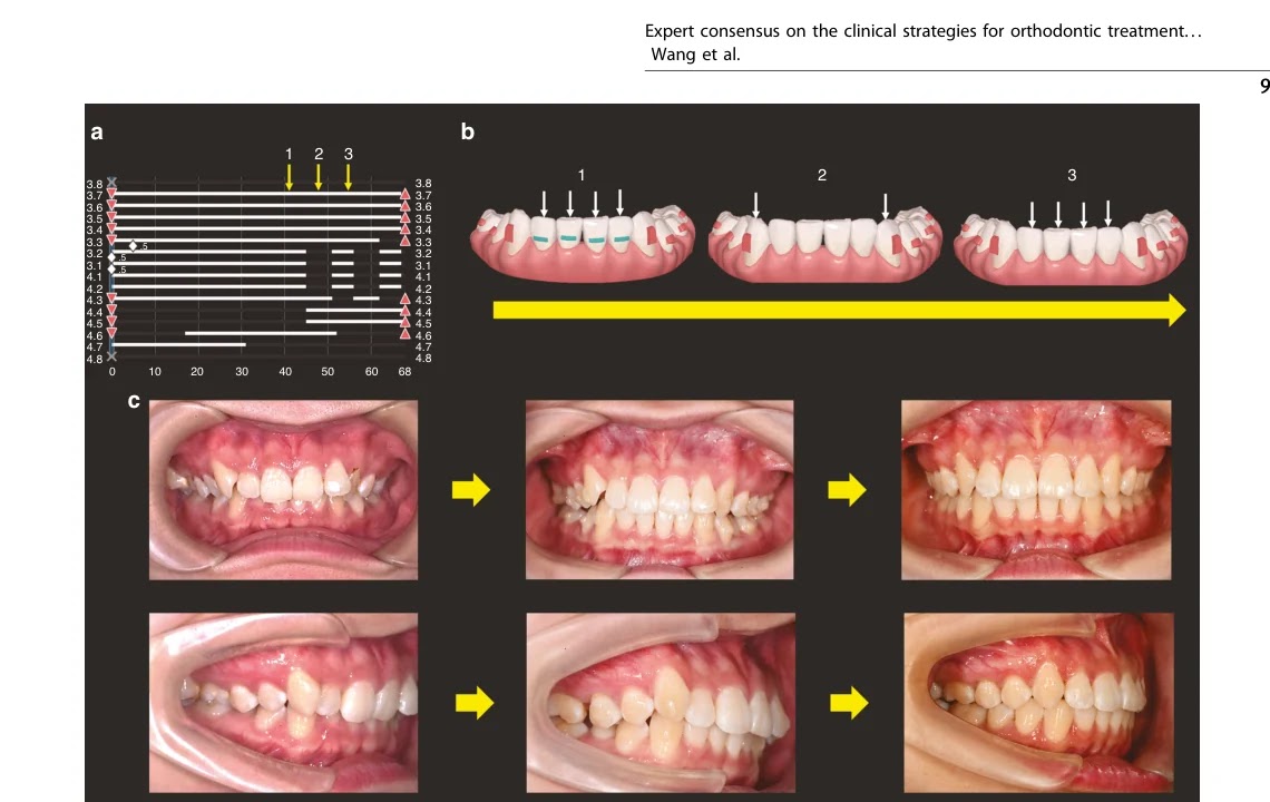 Frog Pattern 스테이징