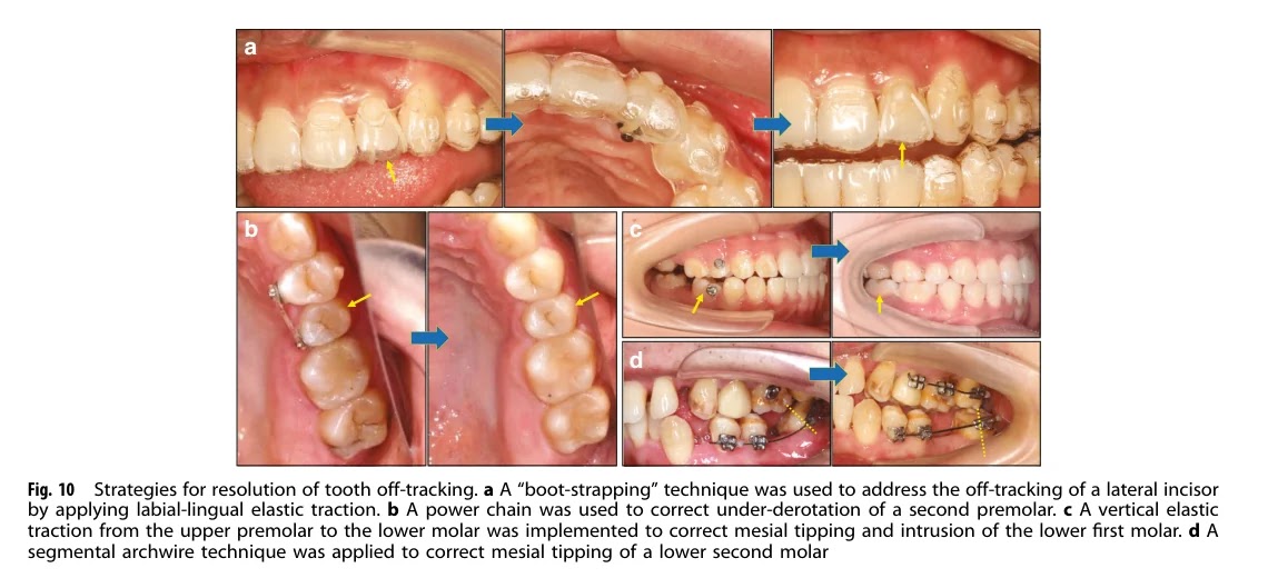 Off-tracking 해결 전략