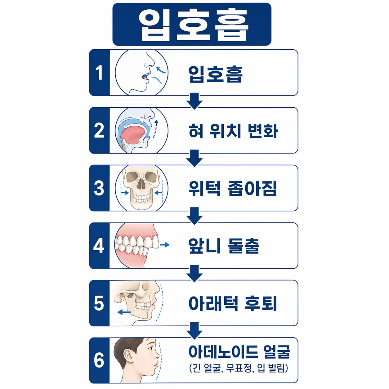 구호흡이 얼굴형을 바꾸는 과정 인포그래픽