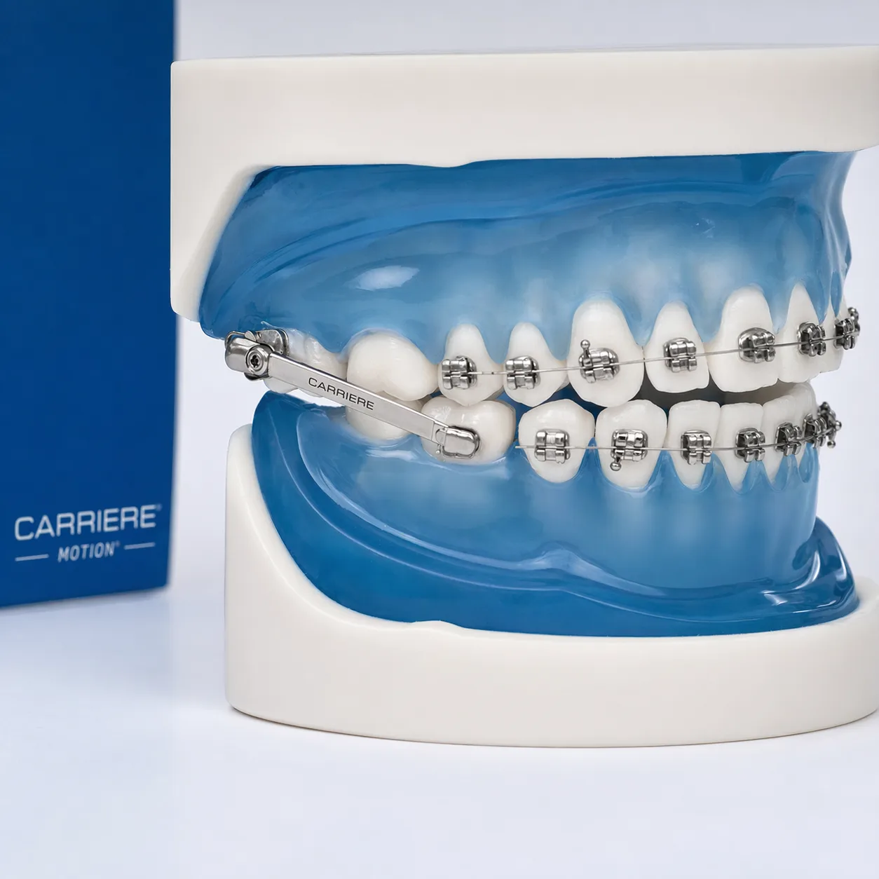 캐리에모션 장치 치아 모형