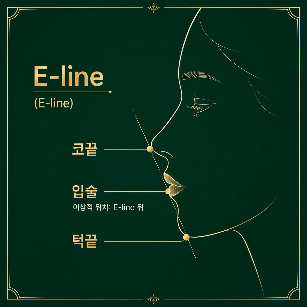 E-line 다이어그램 인포그래픽