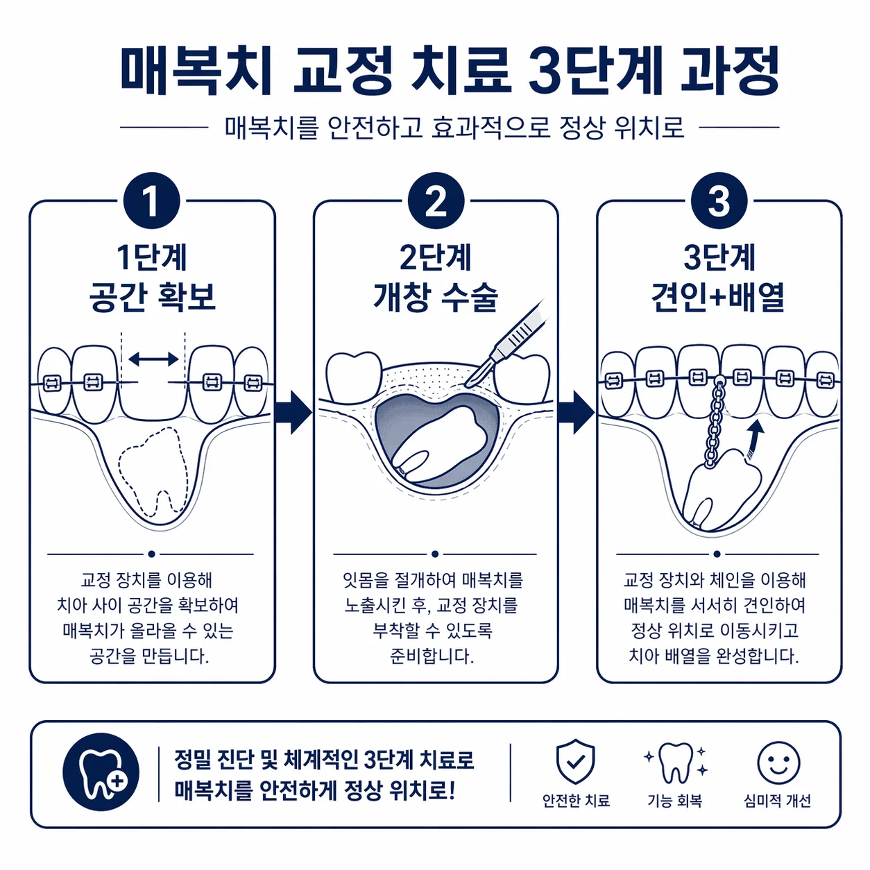 견인 3단계 과정