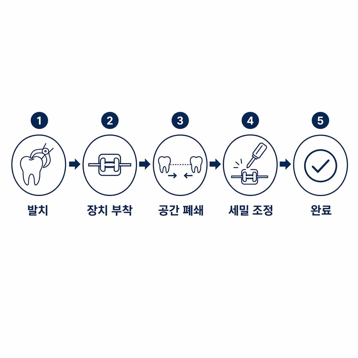 발치 교정 순서 타임라인