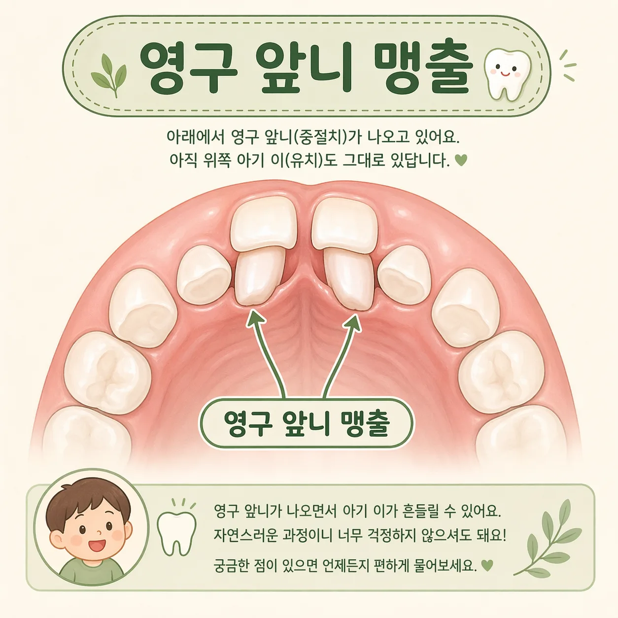 윗니 맹출