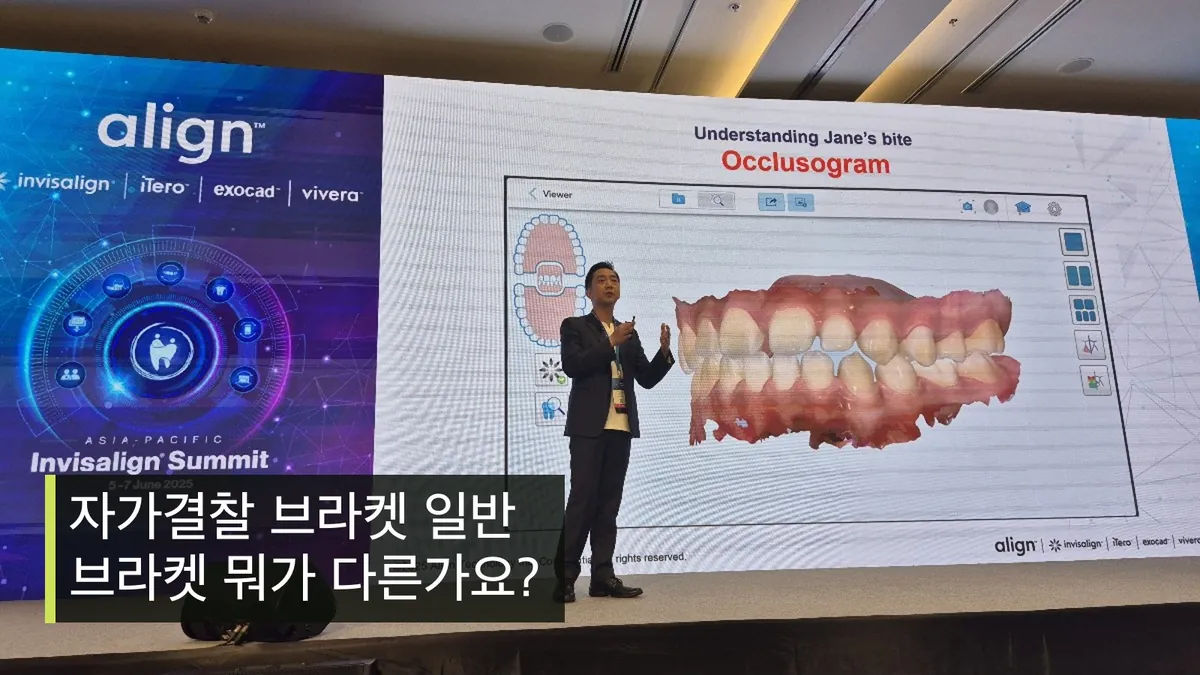 자가결찰 브라켓 일반 브라켓 뭐가 다른가요? | 교정전문의