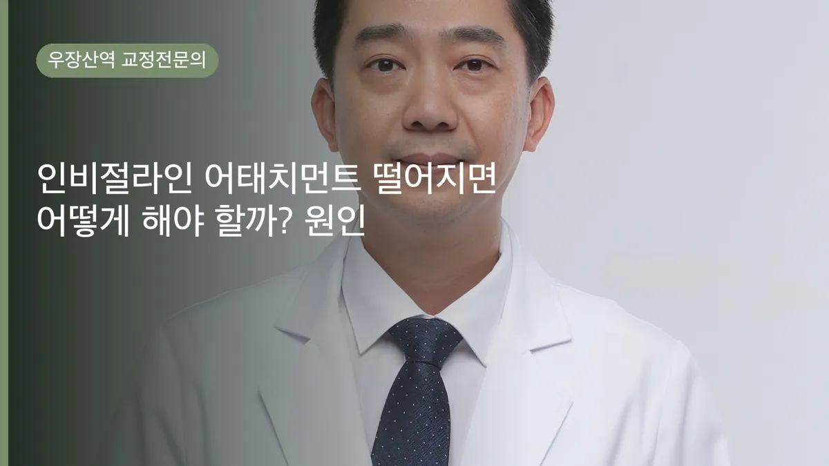 인비절라인 어태치먼트 떨어지면 어떻게 해야 할까? 원인·대처·예방 완벽 정리