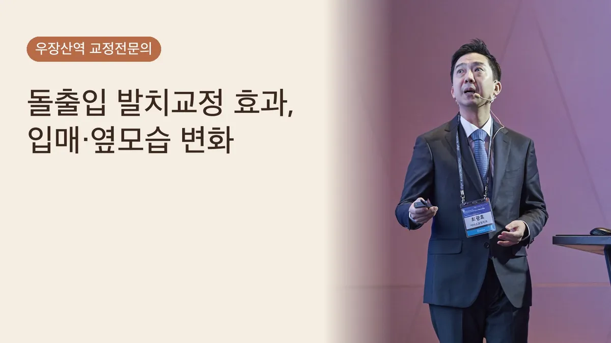 돌출입 발치교정, 효과는 얼마나? 입매·옆모습 변화