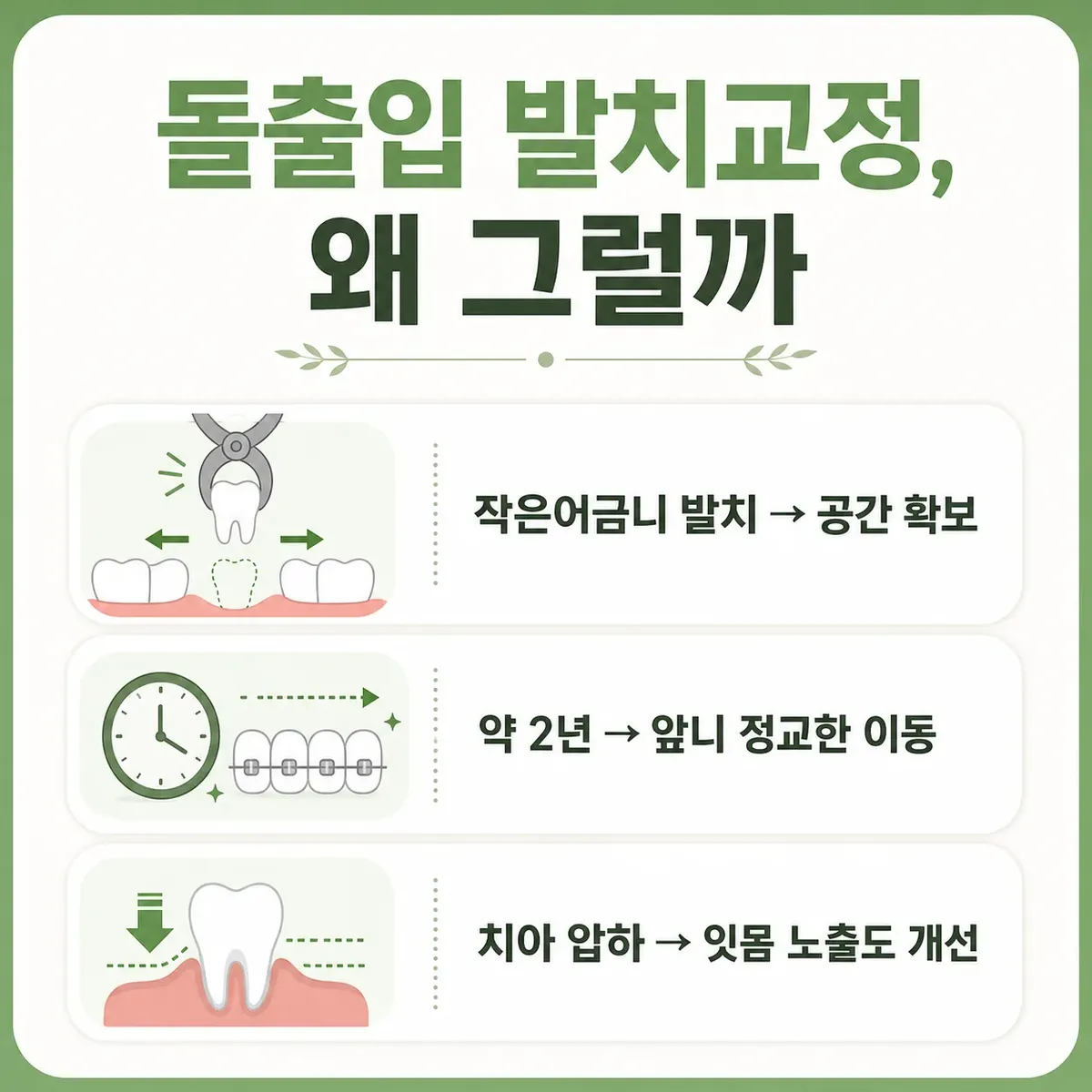 돌출입 발치교정의 발치 개수·기간·잇몸 노출 개선 인포그래픽