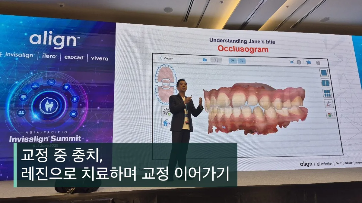교정 중 충치, 레진으로 치료하며 교정 이어가기