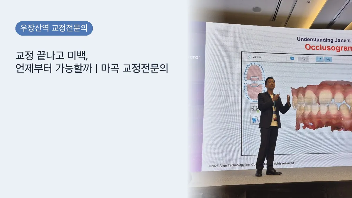 교정 끝나고 미백, 언제부터 가능할까 | 마곡 교정전문의