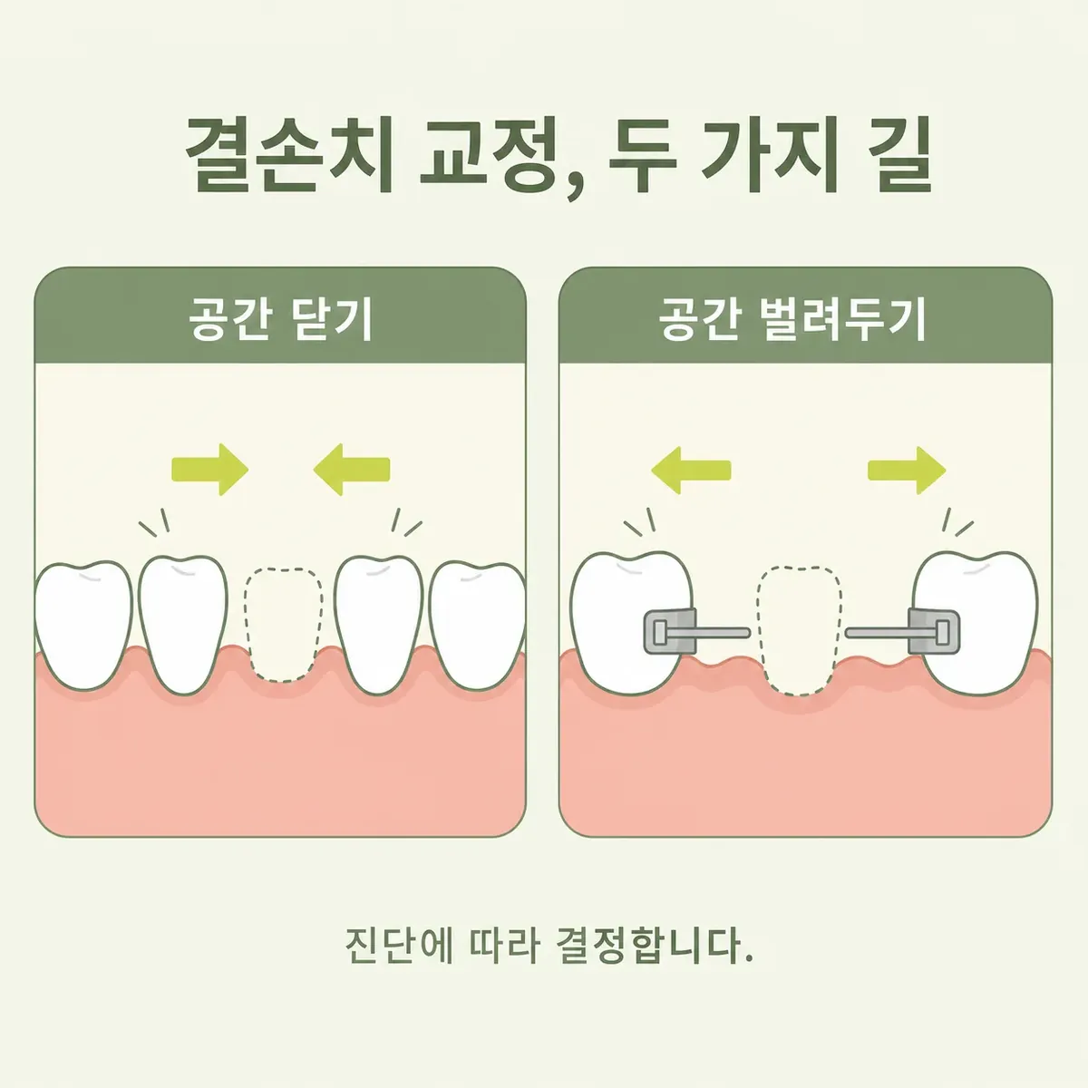 결손치 교정