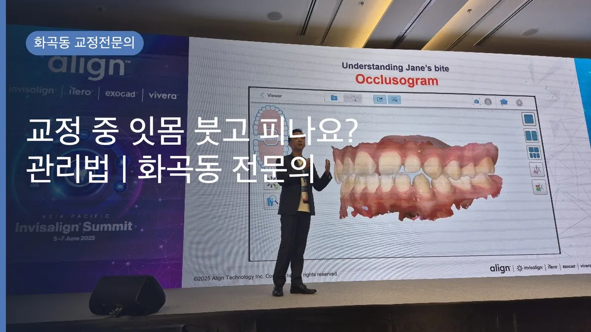 교정 중 잇몸 붓고 피나요? 관리법 | 화곡동 전문의