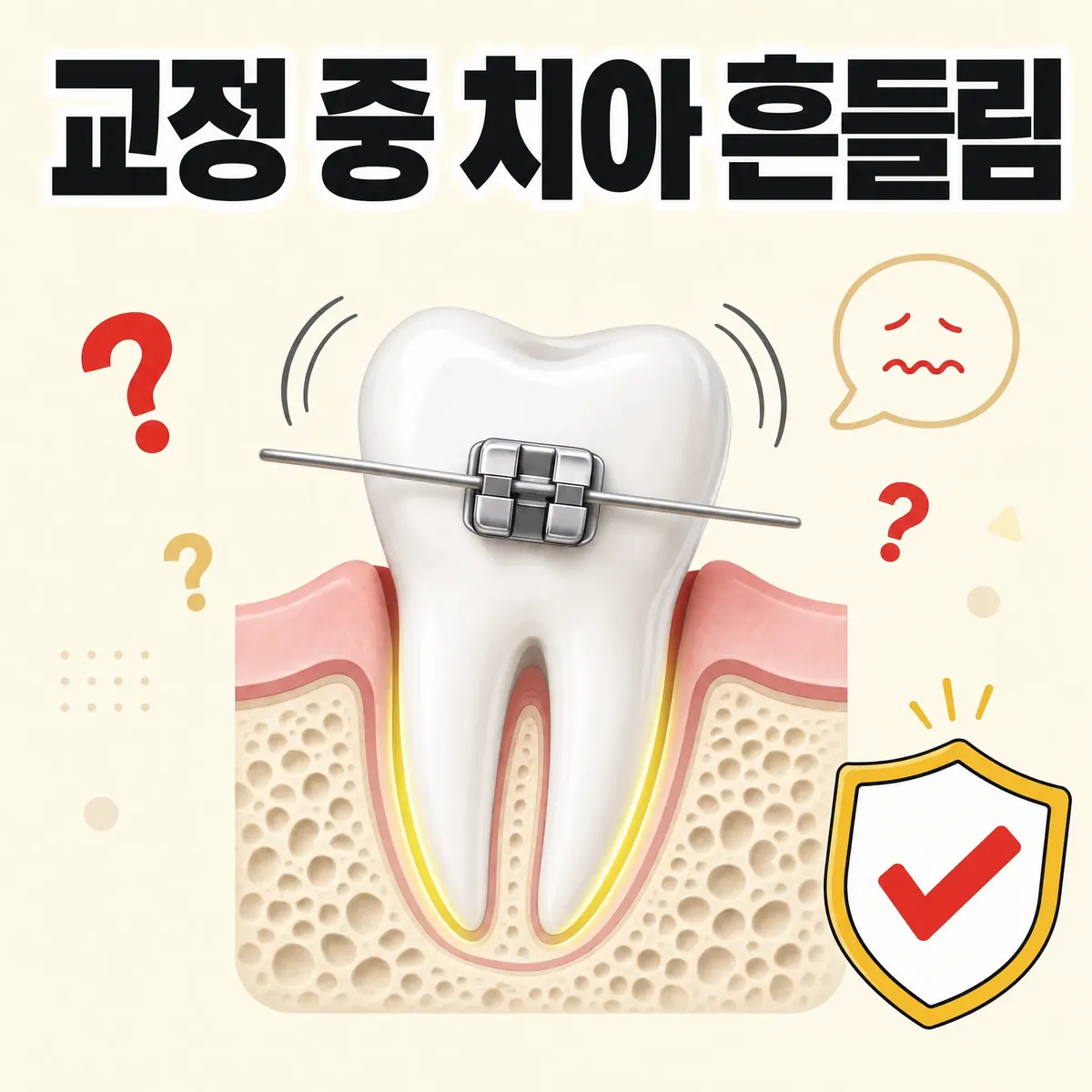교정 치아 흔들림