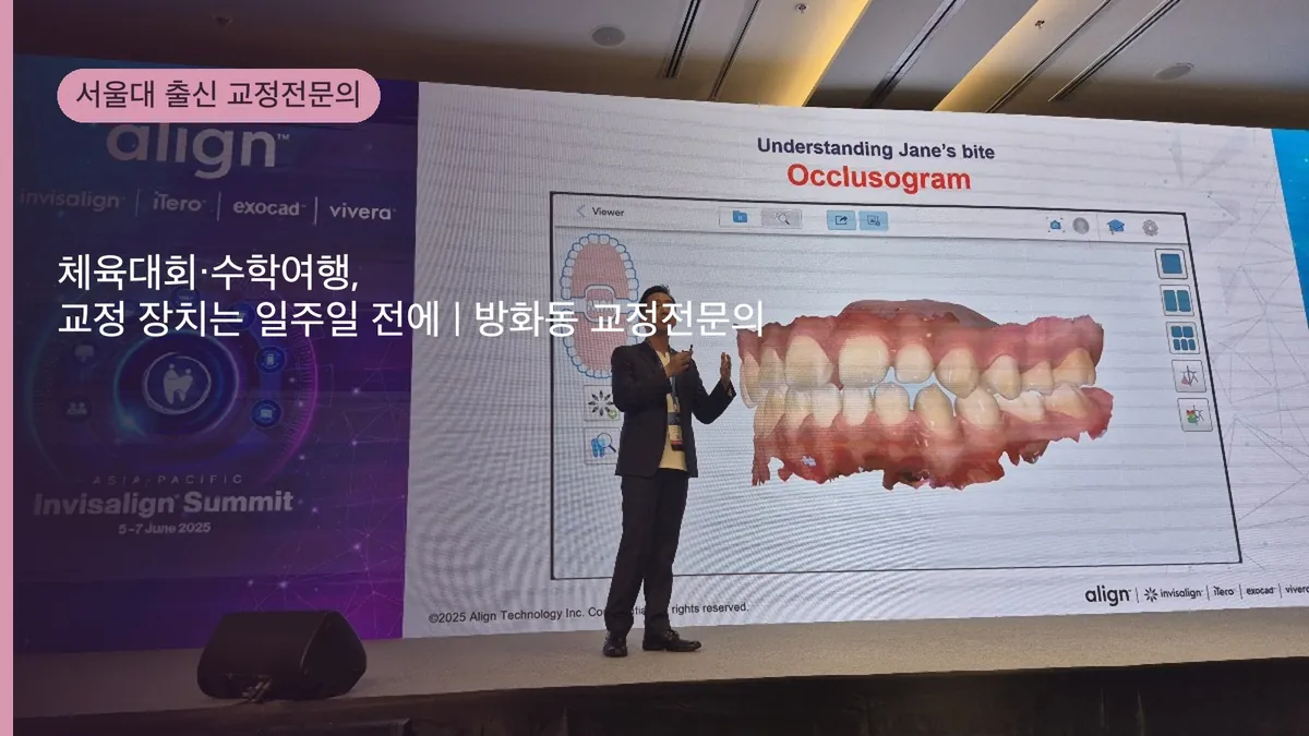 체육대회·수학여행, 교정 장치는 일주일 전에 | 방화동 교정전문의