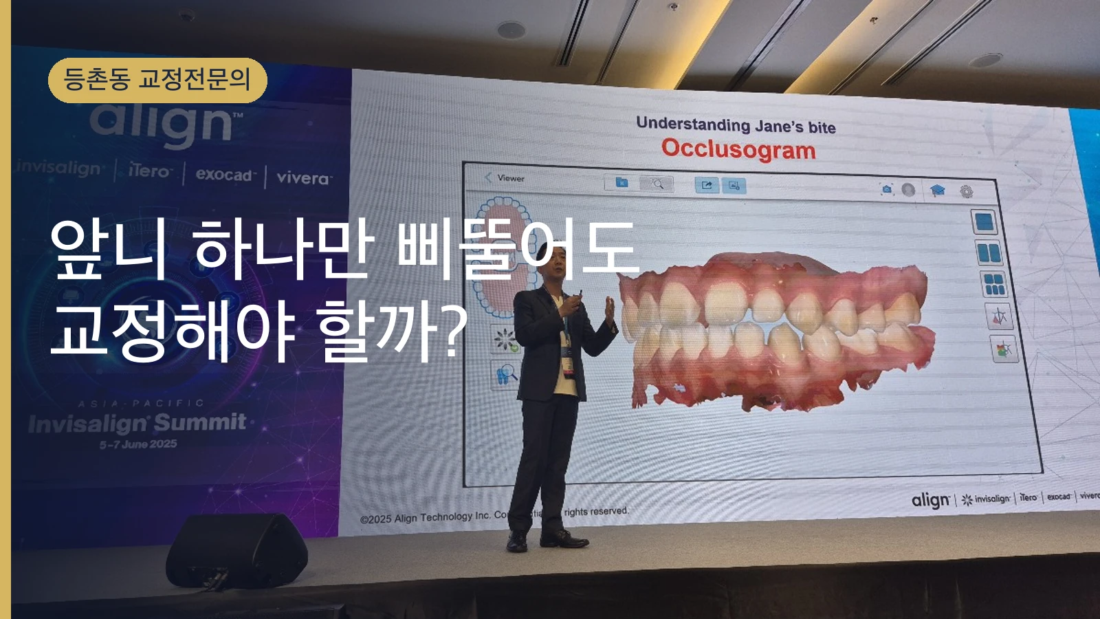 앞니 하나만 삐뚤어도 교정해야 할까? | 교정전문의