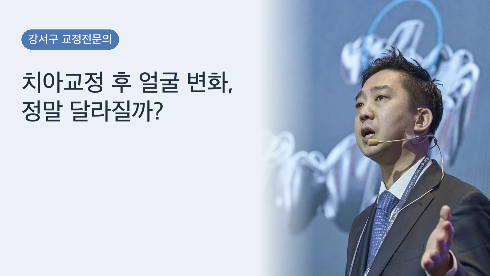 치아교정 후 얼굴 변화, 정말 달라질까?