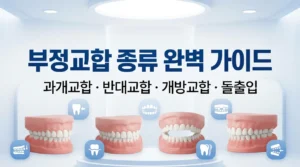 부정교합종류: 과개교합·반대교합·개방교합·돌출입 완전 정리